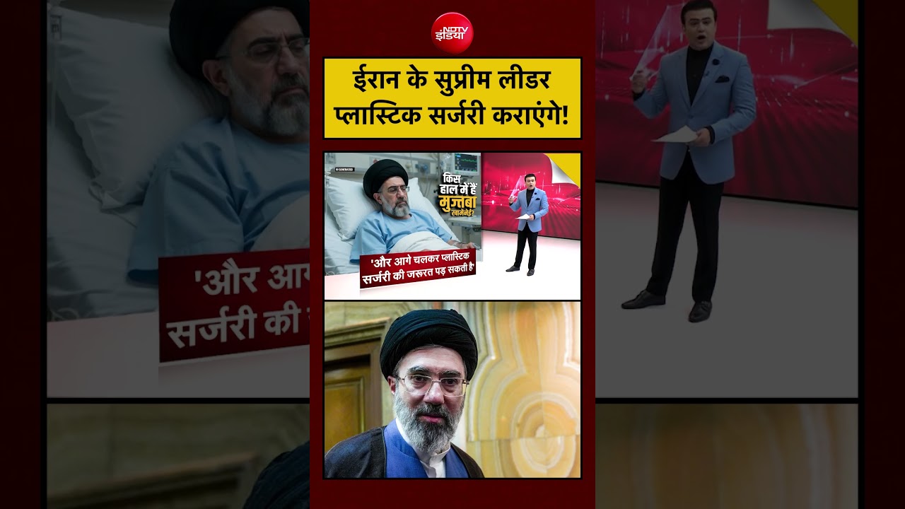 Syed Suhail | Mojtaba Khamenei Health | ईरान के सुप्रीम लीडर प्लास्टिक सर्जरी कराएंगे! #iran #viral